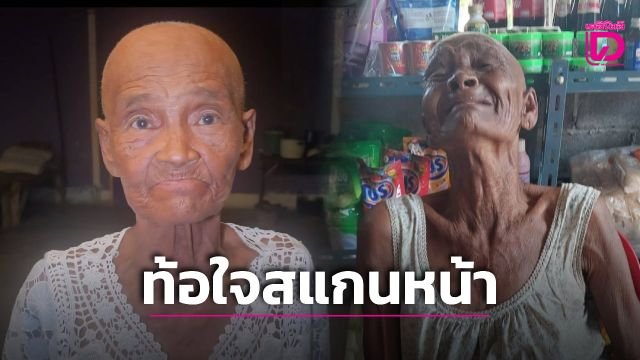 คุณยายวัย 76 ป่วยมะเร็งร้องไห้โฮ หลังสแกนหน้าบัตรสวัสดิการรัฐไม่ผ่านเพราะโกนผม