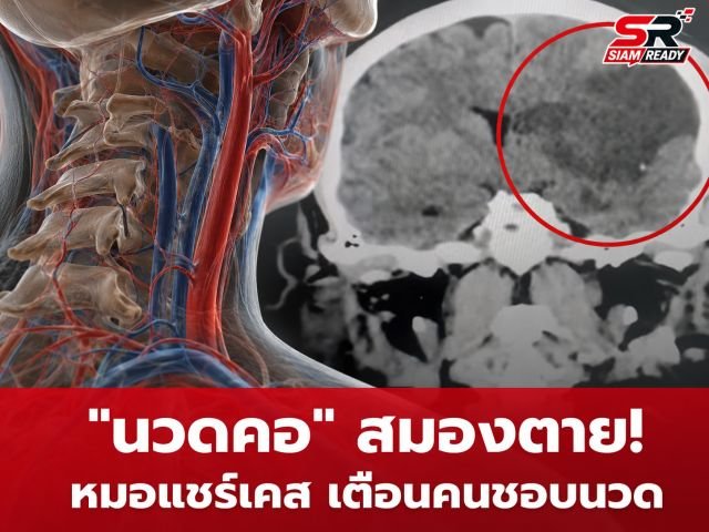 เตือนภัยนวดคอผิดวิธี! แพทย์แชร์เคสชายสมองตาย ชี้จุดอันตรายเสี่ยงสโตรกถึงชีวิต