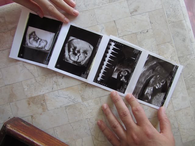ข่าวดีรับปี 69! 'ไฮโซกี้ สราวุธ' ประกาศข่าวดี 'มินนี่ ภัณฑิรา' ตั้งท้องลูกคนแรกแล้ว