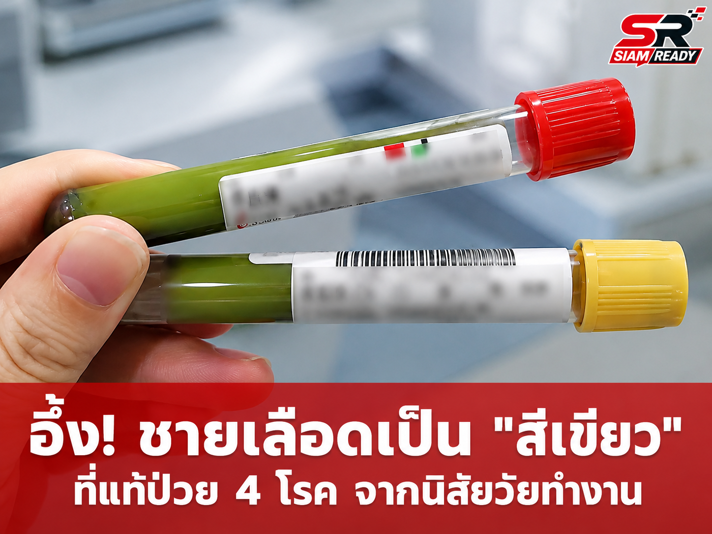 เตือนภัยวัยทำงาน! ชายวัย 36 เลือดเปลี่ยนเป็นสีเขียวข้น พบป่วยหนักพร้อมกัน 4 โรค