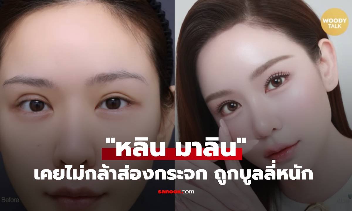 เปิดใจ หลิน มาลิน กับปมศัลยกรรมตาพลาดนาน 2 ปี จนไม่กล้าส่องกระจก