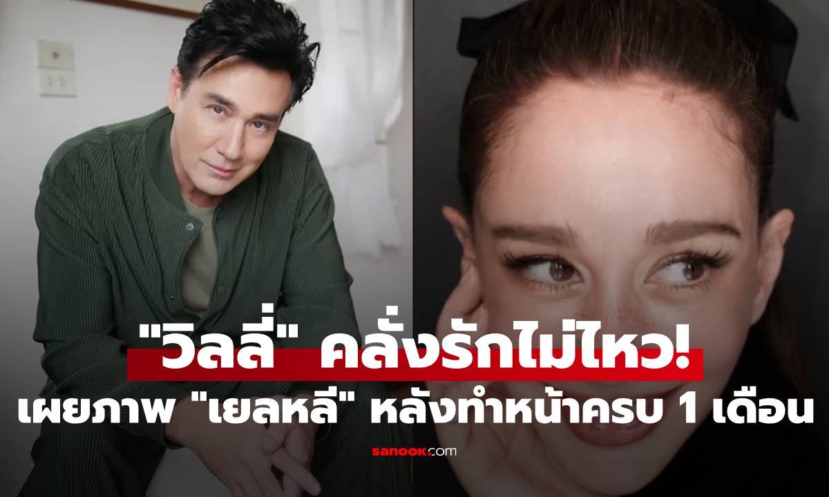 วิลลี่ สุดปลื้ม! อวดโฉม เยลหลี หลังศัลยกรรมครบ 1 เดือน ลั่นเหมือนได้ภรรยาใหม่