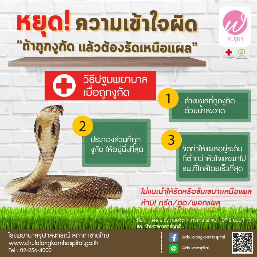 12 ความเชื่อผิดๆ ในการปฐมพยาบาล ยิ่งทำยิ่งอันตราย เสี่ยงอาการทรุดหนัก