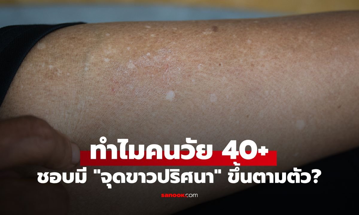 ไขข้อสงสัย 'จุดขาว' บนผิวหนังวัย 40+ คืออะไร? หมอเผยไม่ใช่โรคด่างขาว