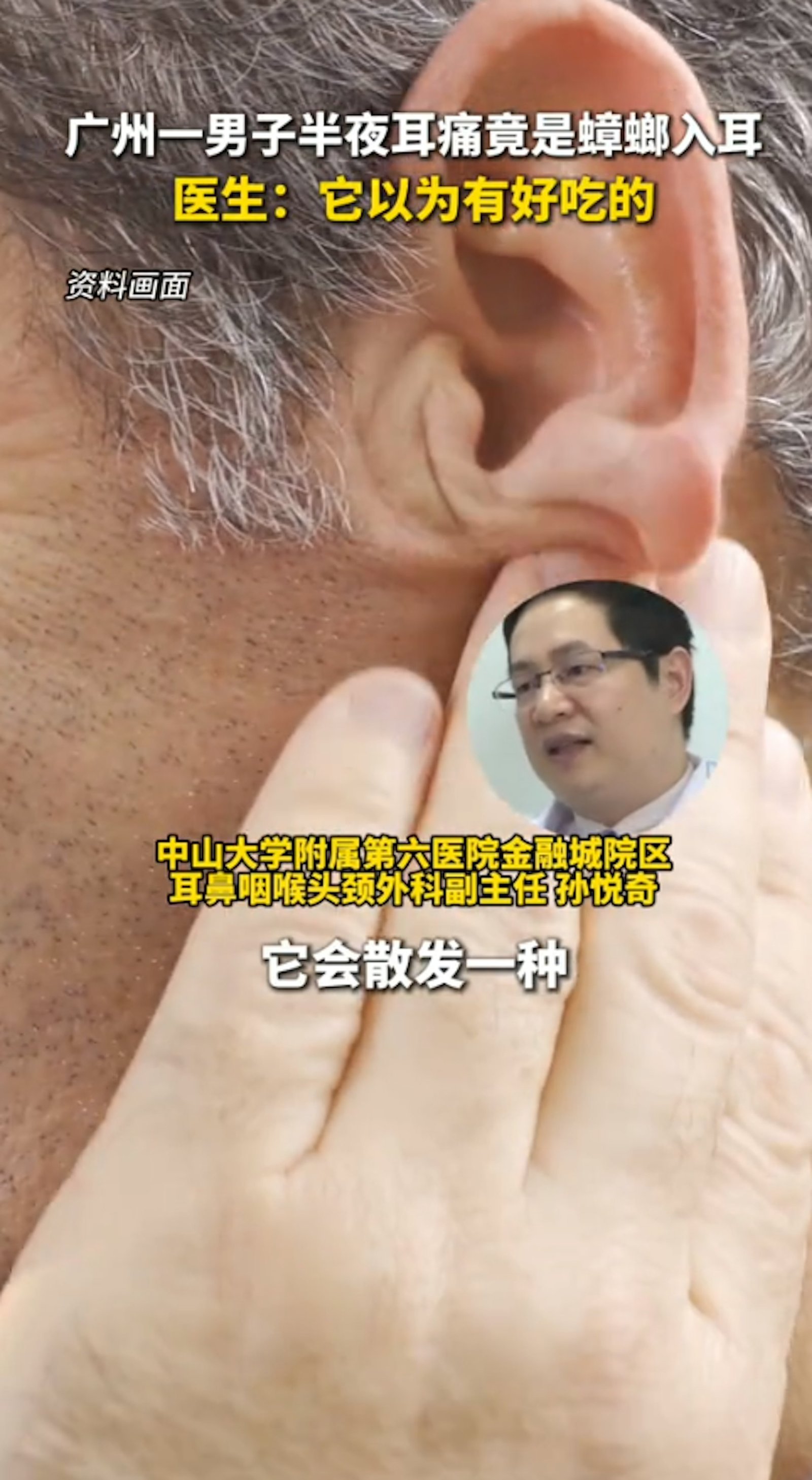 ไขข้อสงสัย! ทำไมแมลงสาบชอบเข้าหู พร้อมวิธีรับมือที่ถูกต้องและข้อห้ามเด็ดขาด