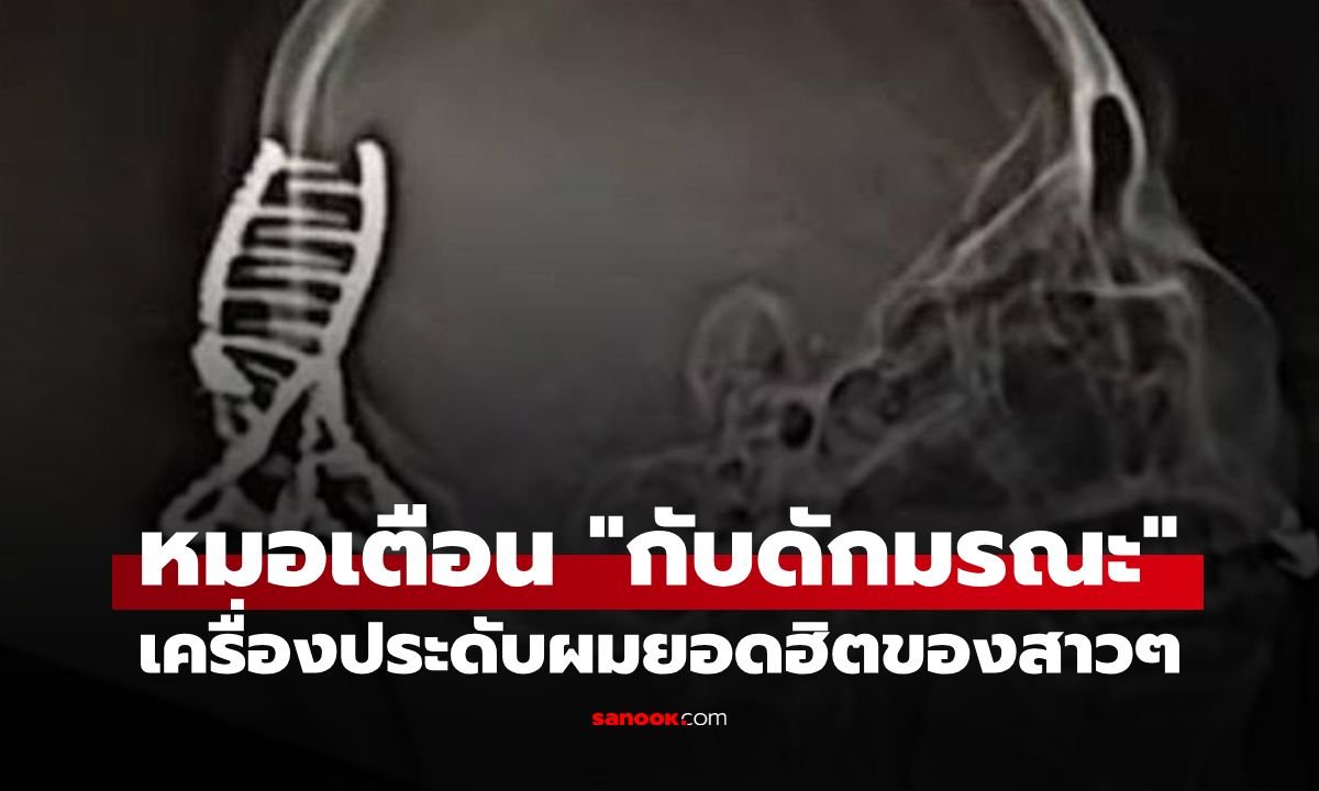 แพทย์เตือนภัย! กิ๊บหนีบผมไอเทมยอดฮิต เสี่ยงกลายเป็น 'กับดักมรณะ' หากเกิดอุบัติเหตุบนท้องถนน