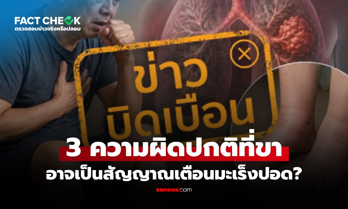เช็กด่วน! 3 อาการผิดปกติที่ขา สัญญาณเตือนมะเร็งปอดจริงหรือ?