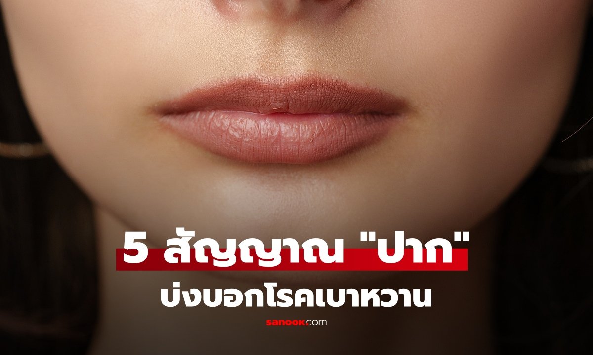 เตือนภัยสุขภาพ! 5 สัญญาณเตือนจาก 'ช่องปาก' ที่อาจบ่งบอกถึงโรคเบาหวานชนิดที่ 2