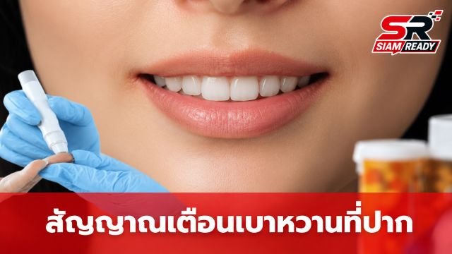 เตือนภัยสุขภาพ! 5 สัญญาณเตือนจาก 'ช่องปาก' ที่อาจบ่งบอกถึงโรคเบาหวานชนิดที่ 2