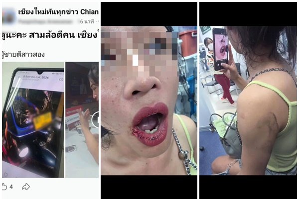 สาวประเภทสองร้องสื่อ ถูกโชเฟอร์ตุ๊กตุ๊กเชียงใหม่ทำร้ายร่างกายจนปากฉีก