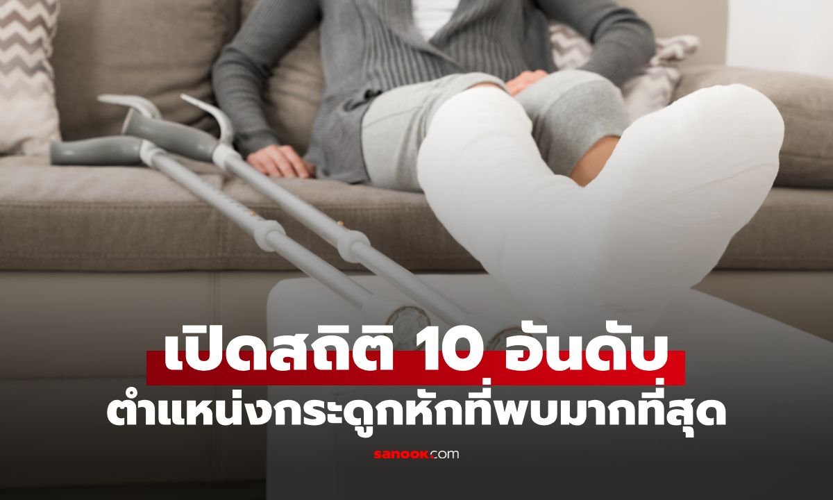 เปิดสถิติ 10 ตำแหน่งกระดูกหักที่พบบ่อยที่สุดทั่วโลก ชี้เพศชายเสี่ยงสูงกว่าจากกิจกรรมผาดโผน