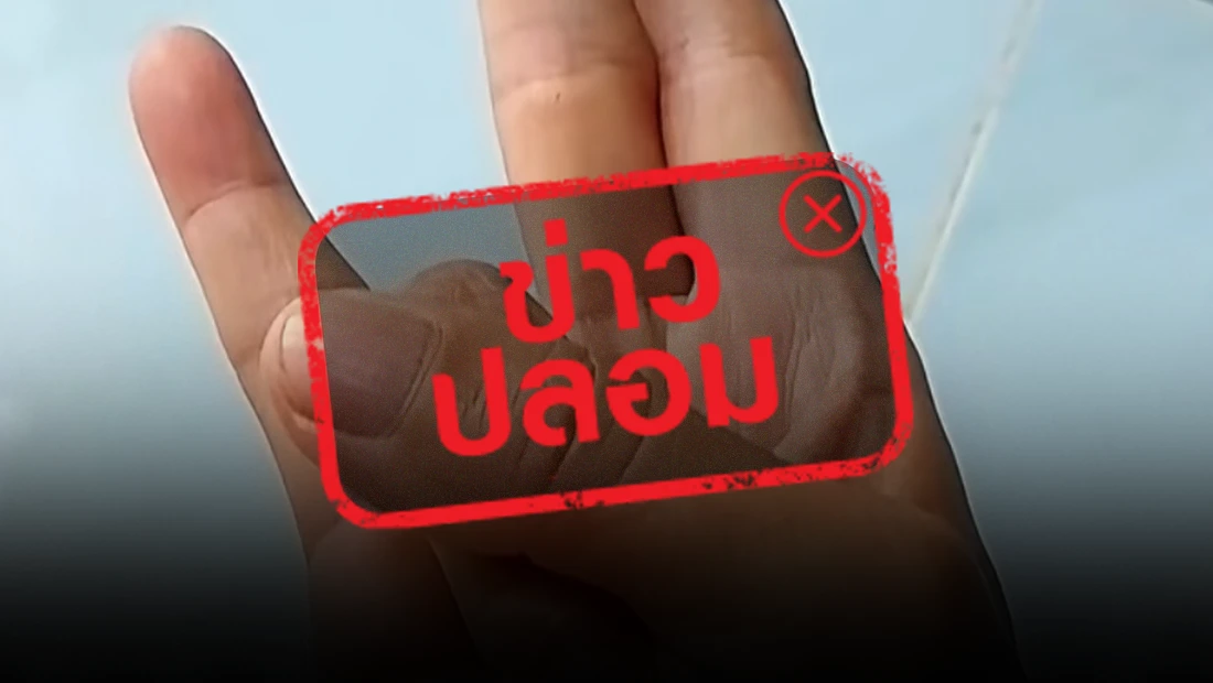 กรมการแพทย์เตือน! ข่าวปลอม อ้างใช้นิ้วกดทับกันป้องกันมะเร็งได้