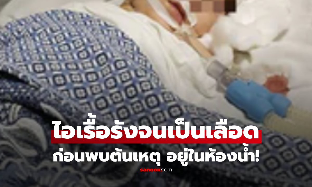 เตือนภัยไอเรื้อรัง! หญิงป่วยปอดพัง 3 ปี พบต้นเหตุจาก 'ฝักบัว' ในห้องน้ำ